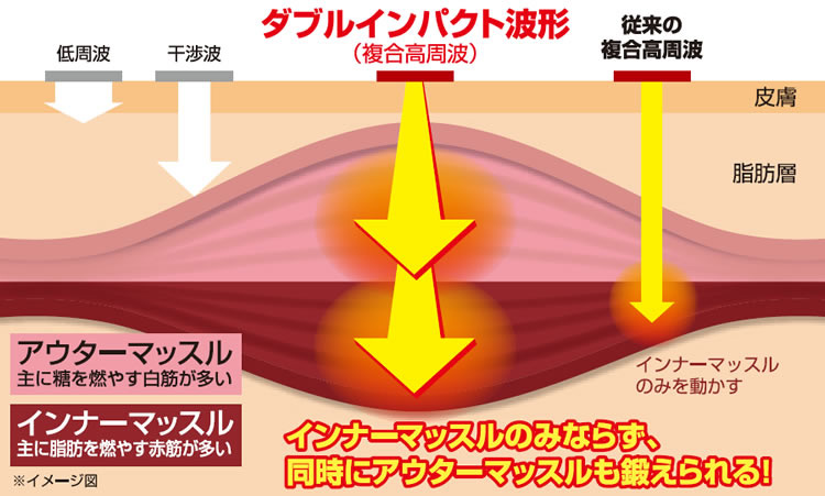 複合高周波の特徴