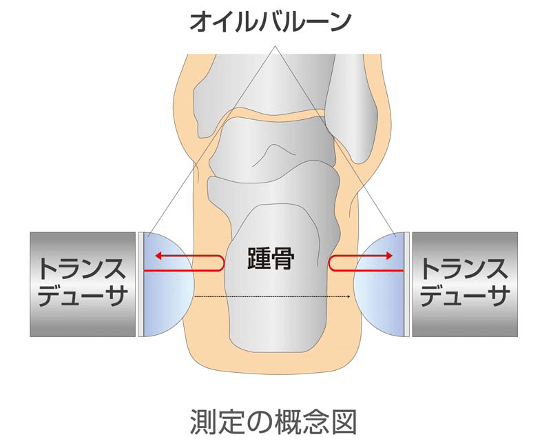 固定式トランスデューサ