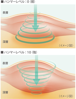 症状にあわせて選択。<br>ハンマー(刺激)レベル設定