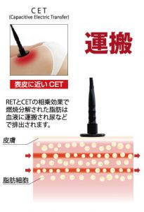 表皮にCET方式<br>(Resistive Electrode Transfer)