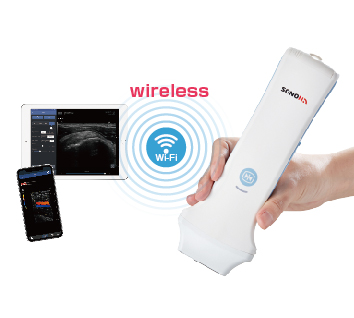 超音波画像診断装置 SONON 300L